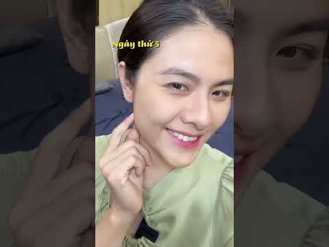Diễn viên Vân Trang nói gì về peel da Mocha