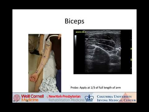 Heakyung Kim - Upper Limb Muscles US workshop Part I