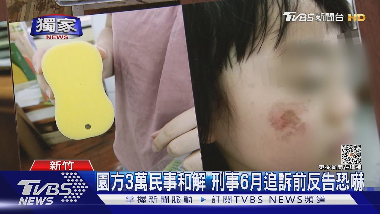 女童麥克筆畫臉 師持菜瓜布硬洗「刷破臉」