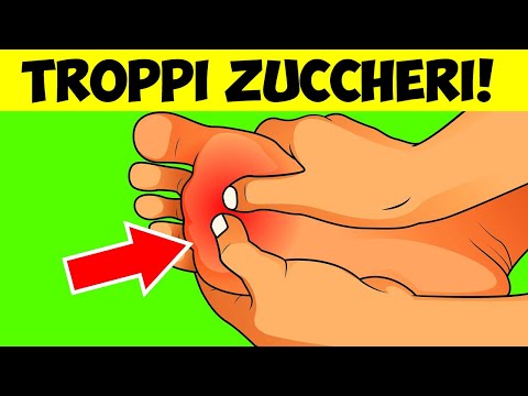 download lagu mp3 mp4 Troppi Zuccheri, download lagu Troppi Zuccheri gratis, unduh video klip Troppi Zuccheri
