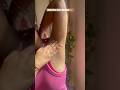 Underarm Care Routine Dark Underarms Ashortaday Skincare Beautytips Underarmwhitening Viral