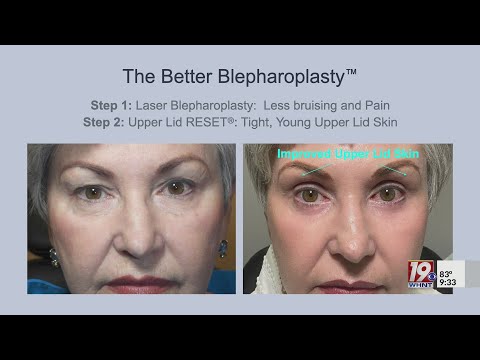 Recent Advancement in Upper Lid Blepharoplasty | Sept. 23, 2024 | News 19 at 9 a.m.