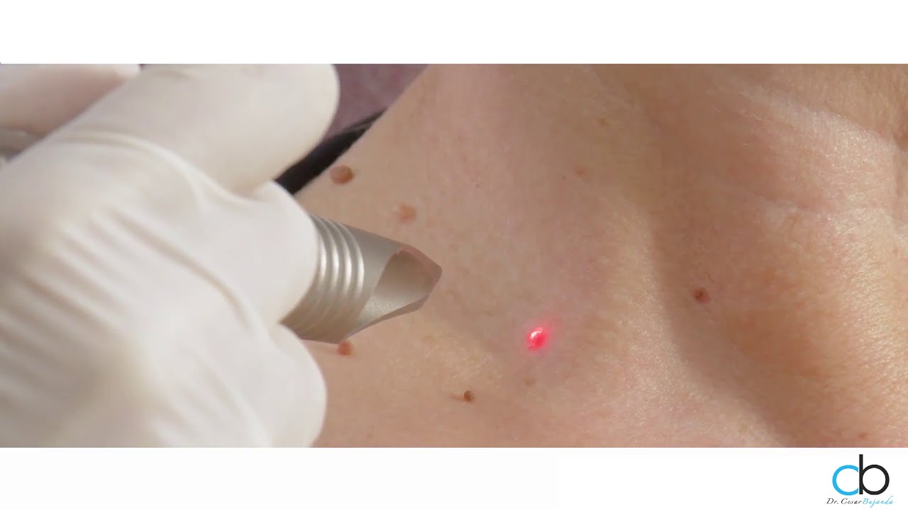 César Noé Bujanda Mena-22