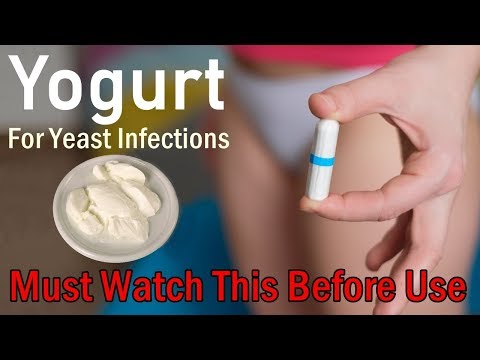 Does Yogurt Work for Yeast Infections - Must Watch This Before Use Video