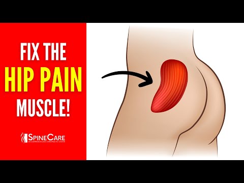 Đoạn giới thiệu Release THIS Muscle for Instant Hip Pain Relief