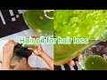 Secrets To Treat Hair Fall Alopecia Thinning Baldness Dandruff Massive Hair Growth
