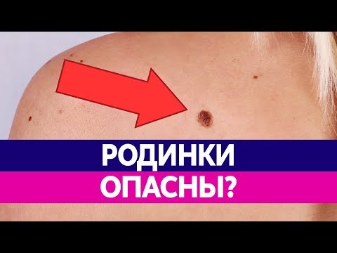 Сыворотка филорга против пигментных пятен Як видалить веснушки