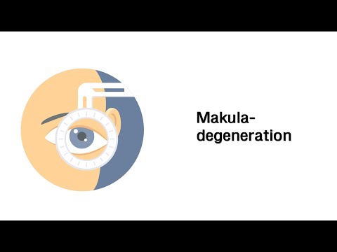 Makuladegeneration - Erkrankungen der Augen