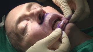 Dr. Philip Young