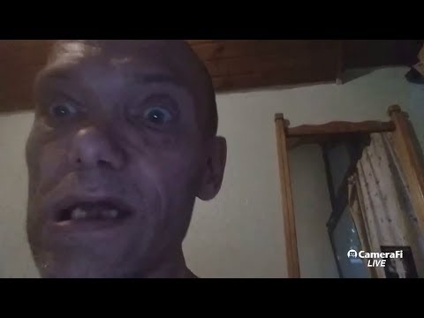 Klassifizierung von Prostatakrebs Gleason Kerzen vitaprost 50 mg Führer