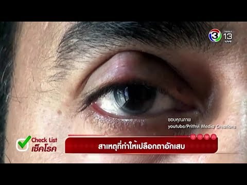 ส่วนใหญ่ยาเสพติดใหม่สำหรับโรคสะเก็ดเงิน โรคสะเก็ดเงิน Malyshev วิดีโอ