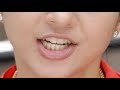 Yami Gautam Parineeti Chopra And More Actress EXpression