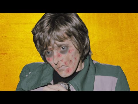 Billy Fury Suffered from an Illness That Killed Him at 43 Years Old