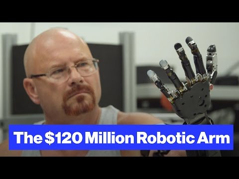 How much does a robotic prosthetic arm cost?
