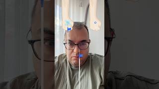 Serum Takma Oyunu 🎮 #game #gameplay #gaming #gamer #gamingvideos