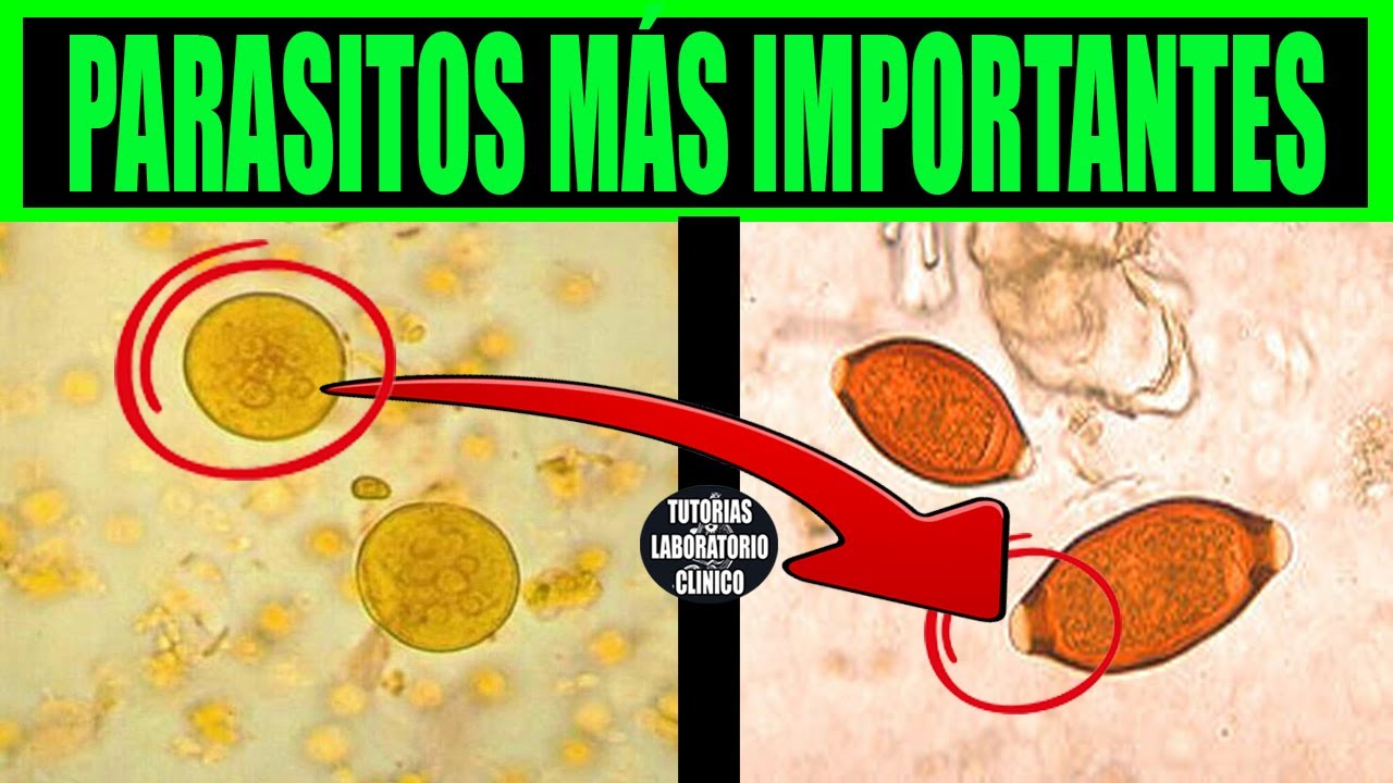 🔬12 PARÁSITOS increíbles que deberías Conocer para Aprobar PARASITOLOGÍA💩