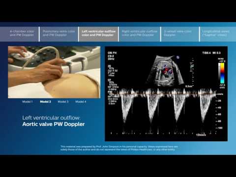 Advanced screening views of the fetal heart - Part 3 - Left ventricular outflow color and PW Doppler