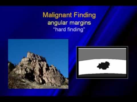 image-What is Spiculation?