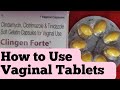 Vaginal tablets kese use krte h| How to use Vaginal Tablets