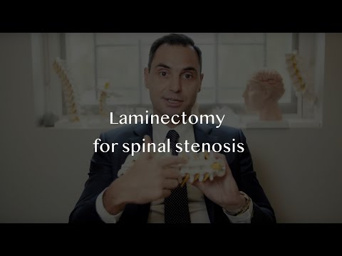 Surgery for spinal stenosis - lumbar laminectomy