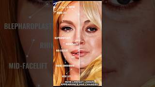 How Lindsay lohan appearance has changed|#cosmeticsurgery #skincare #beauty