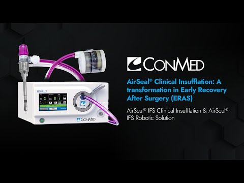 AirSeal® Clinical Insufflation: A Transformation in Early Recovery After Surgery - CONMED