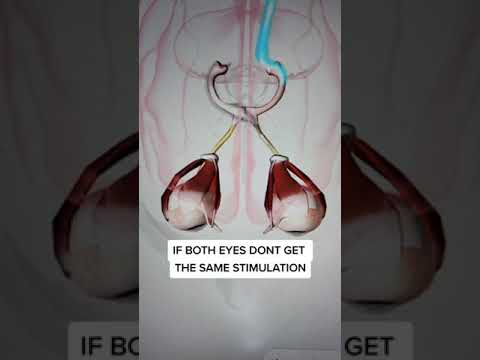 This Gets You a Lazy Eye