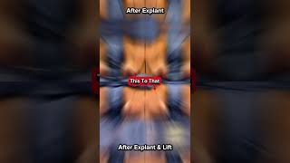 Lampert Md Plastic Surgery