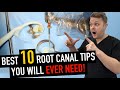 10 Game-Changing Root Canal Tips (You’ll Use Tomorrow!)
