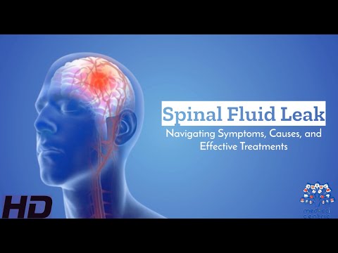 Spinal Fluid Leak SOS: Identifying, Treating, and Preventing