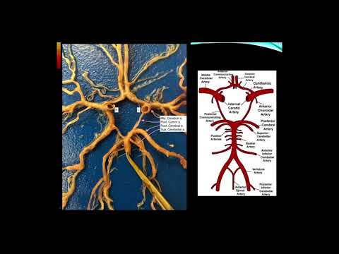 Cerebrovascular Disease,  Part 1