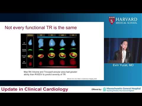 11 Management of Tricuspid Valve Disease (Harvard update) - Freemedbooks.com