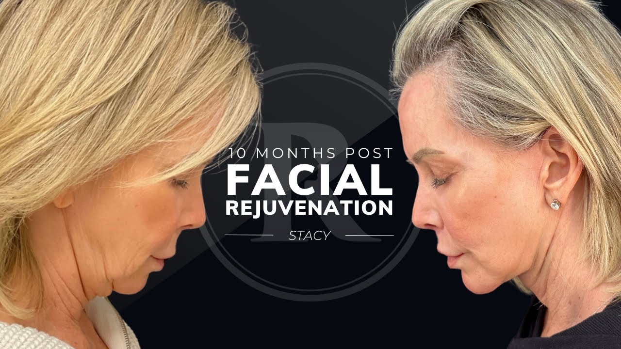 Robb Facial Plastic Surgery