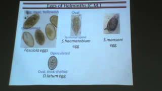 Dr Azza   Protozoa 11   Toxoplasmosis & OSPE   YouTube