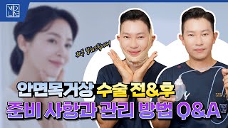 이거 안 지키면 안면거상 망합니다 (주의사항 총정리)