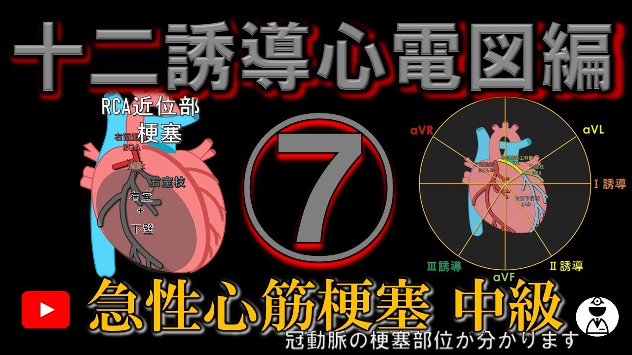急性心筋梗塞⑦中級編 (冠動脈の梗塞部位が分かります)