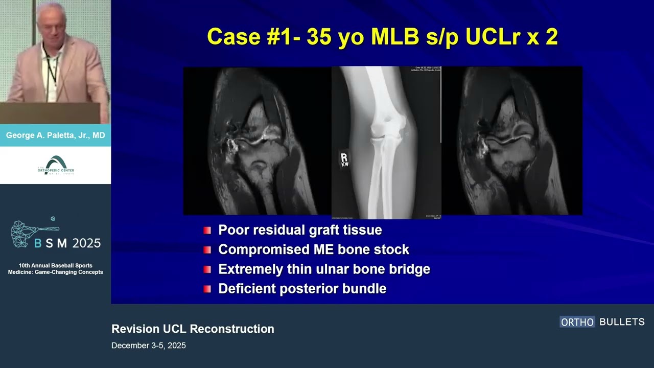 Revision UCL Reconstruction_George Paletta Jnr MD