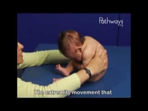 4 Month Old Babies in Sitting Position, demonstrating Typical and Atypical Development