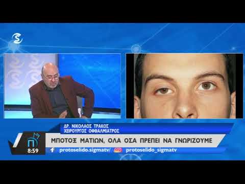 Δρ Νικόλαος Τράκος | Tι είναι η Βλεφαρόπτωση και πώς αντιμετωπίζεται; | "Sigma Tv" 30/01/20