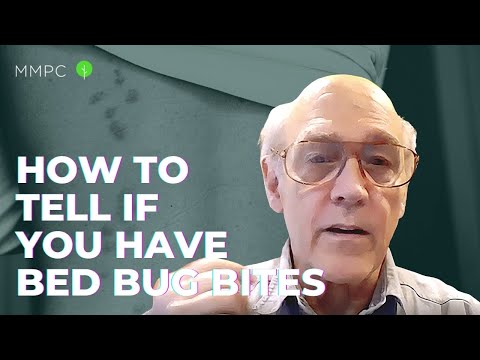 How To Tell If You Have Bed Bug Bites — An Entomologist Explains | MMPC