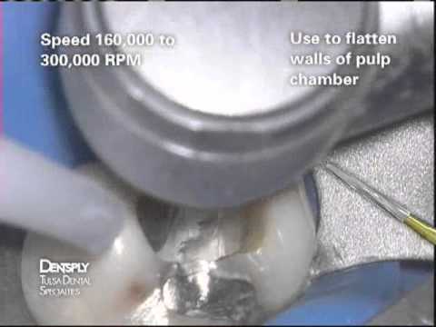 Endo Z Bur review (EAEZ)