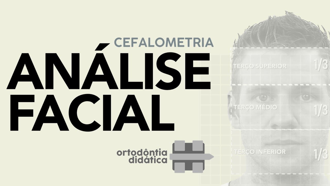 ANÁLISE FACIAL - Cefalometria