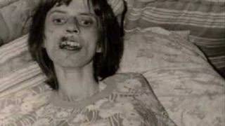 Anneliese Michel , the real Emily Rose
