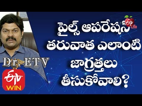 How Long is Recovery After Piles Surgery? | Piles Operation | Laser Surgery for Piles