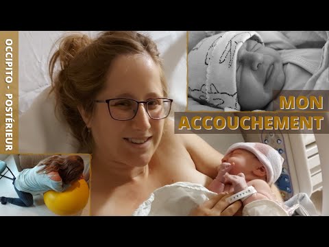 RÉCIT D'ACCOUCHEMENT POSITIF ! : Bébé en position occiput postérieur (OP / SUNNYSIDE UP)