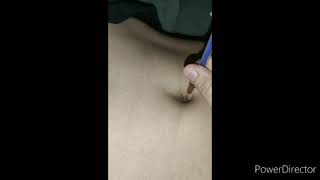 Belly button torture