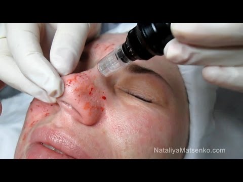 Для веснушек маска Стишок о веснушках