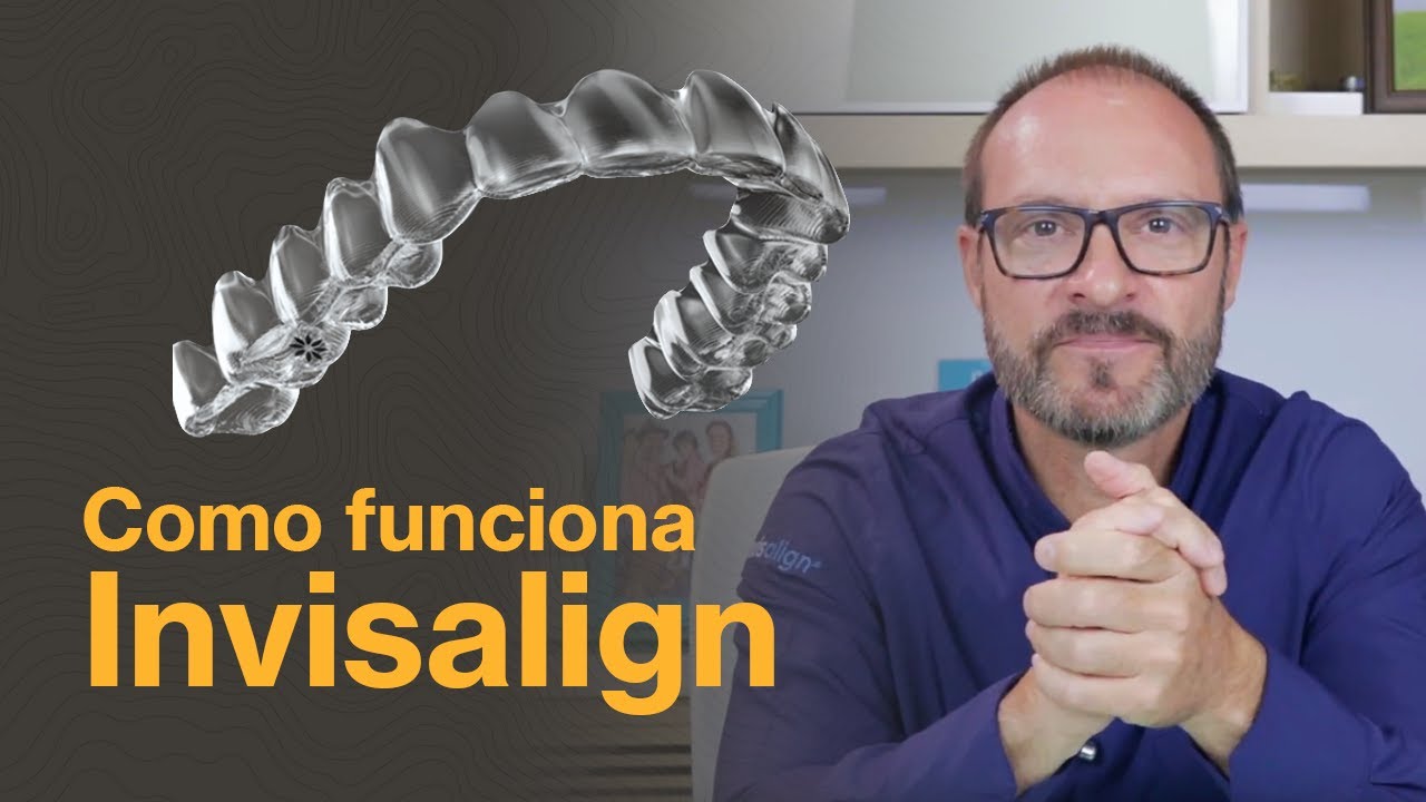 O que é o Invisalign e como funciona - Blumenau SC - Dr. Raul Pistorello