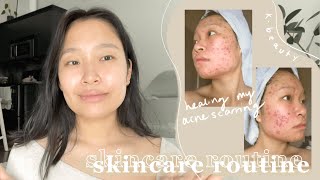 my holy grail skincare routine | how I healed my severe acne scarring, texture & hyperpigmentation
