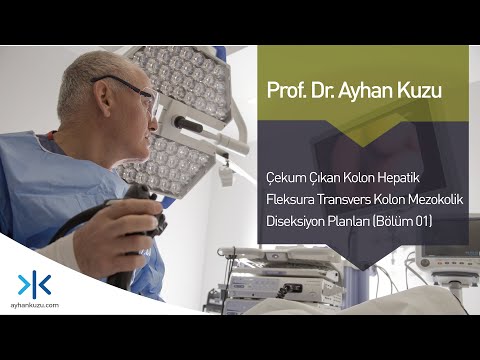 Çıkan Kolon, Hepatik Fleksura, Transvers Kolon Mezokolik Disseksiyon Planları